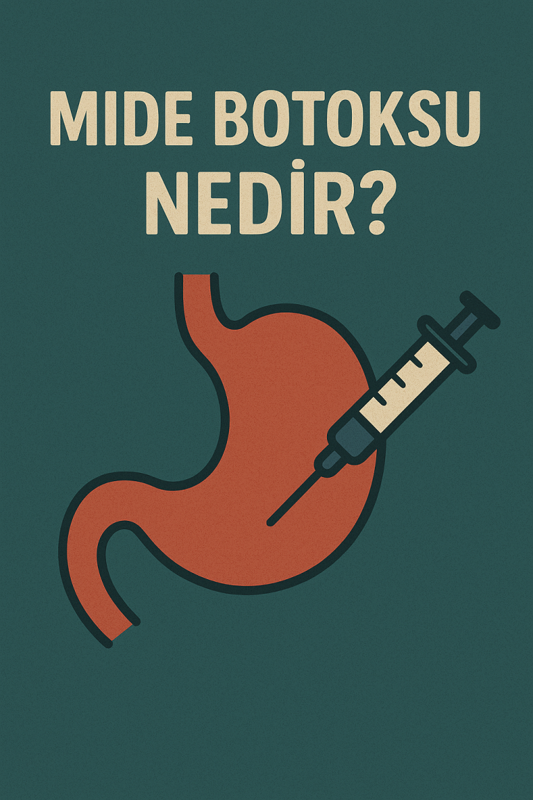 mide botoksu nedir
